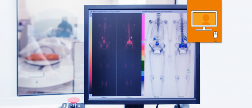 computer screen showing scan of bones in front of screening room